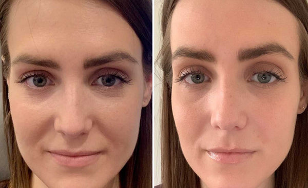 Michelle.P